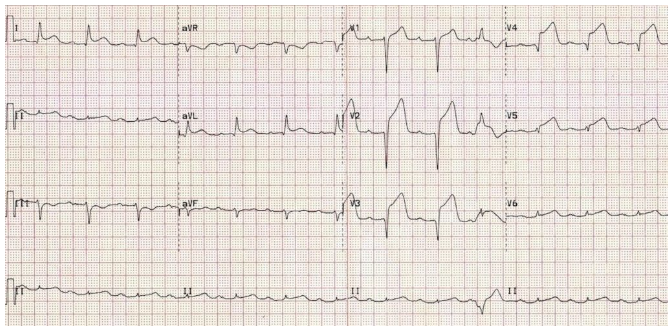 NUR331 Assignment 2 Complex Care Case Study